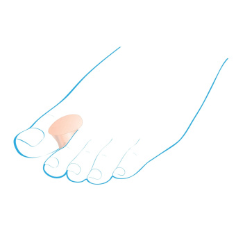 Межпальцевые разделители силиконовые малые, пара